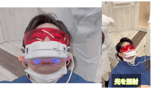 ホワイトニング