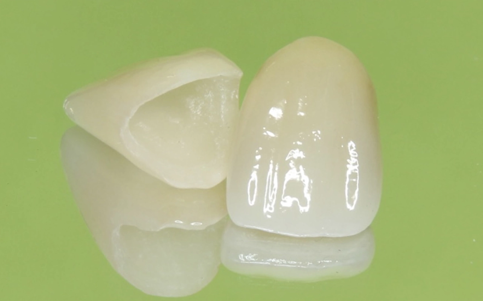 オールセラミック