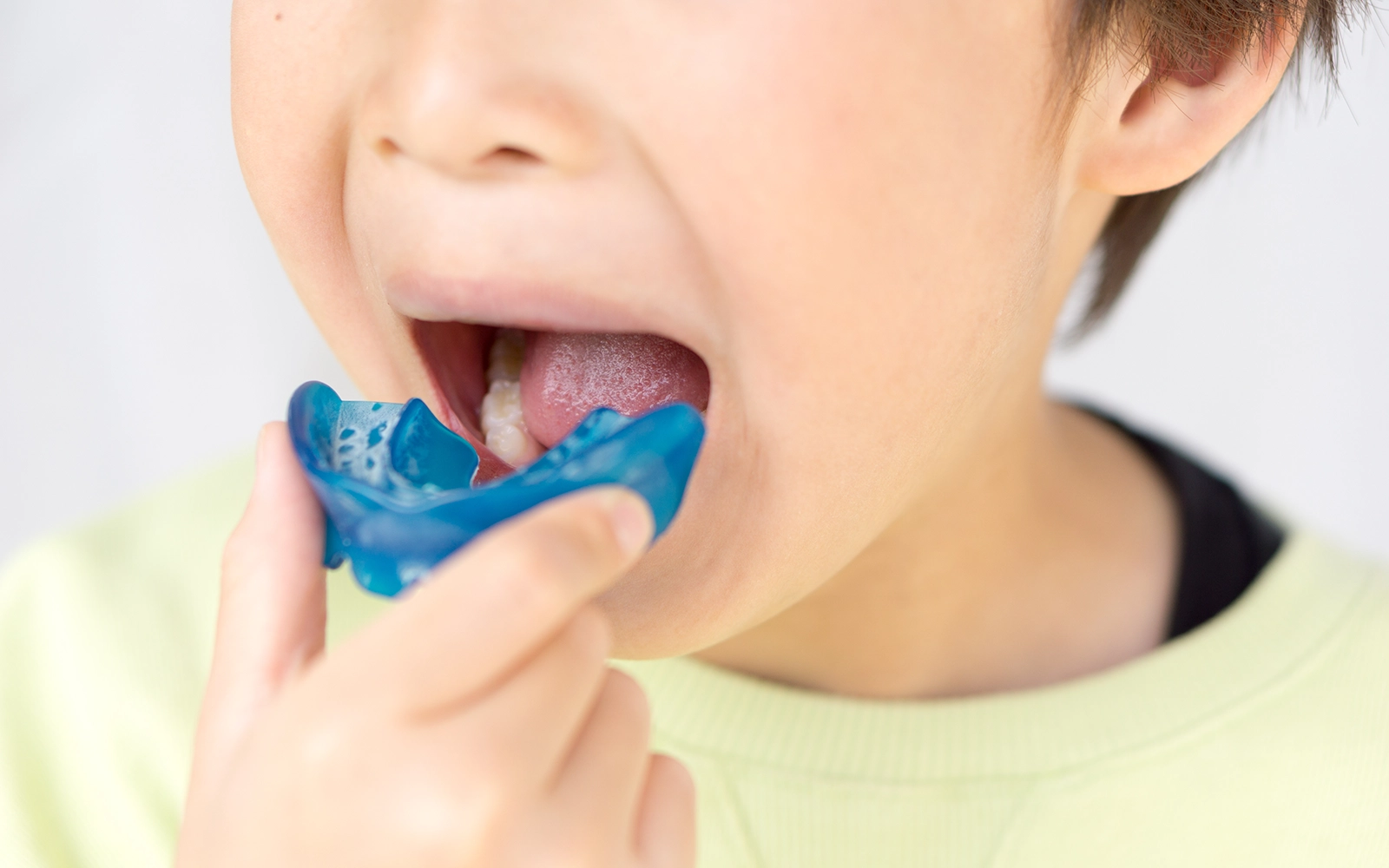 マウスピース型装置