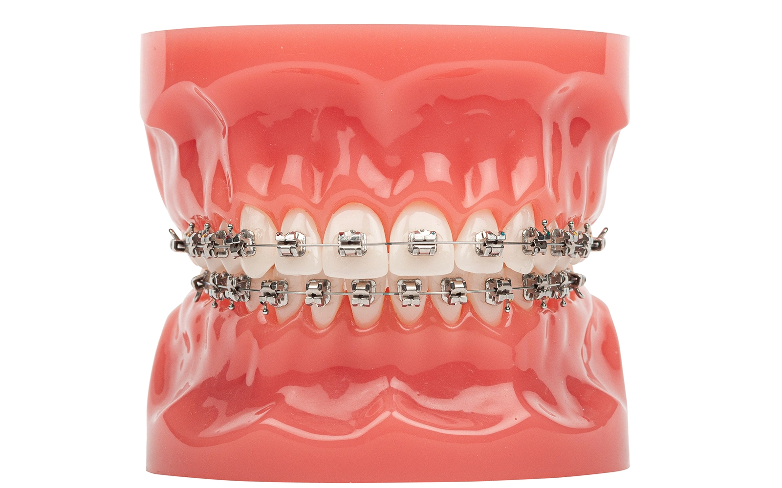 ブラケット矯正装置