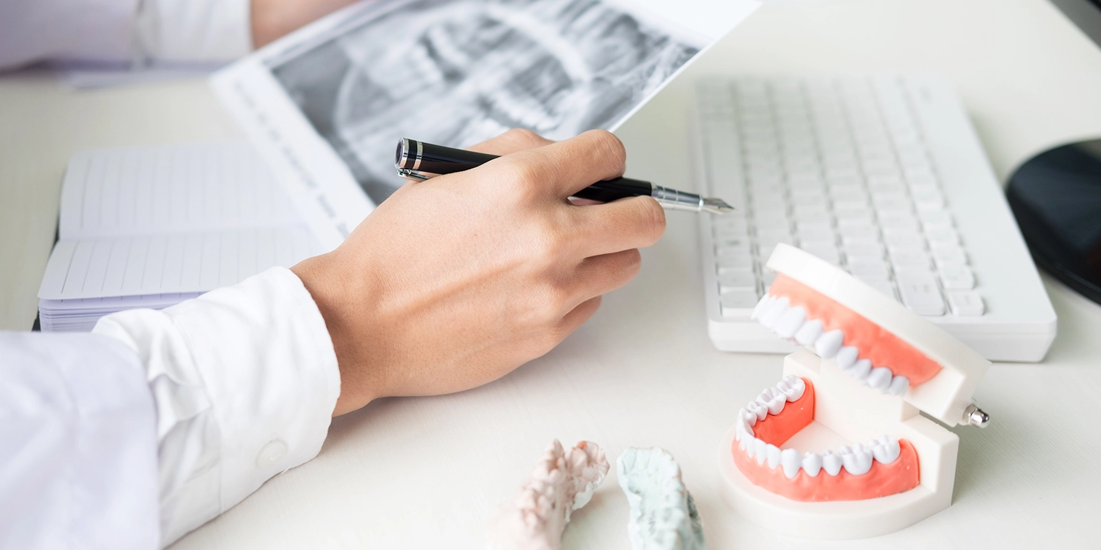 マウスピーズ作成