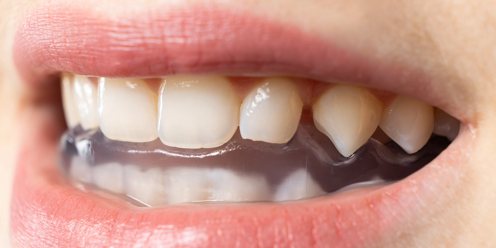 スリープスプリント