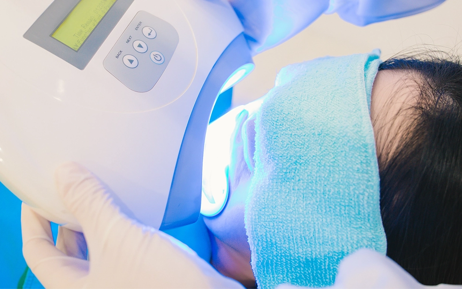 オフィスホワイトニング