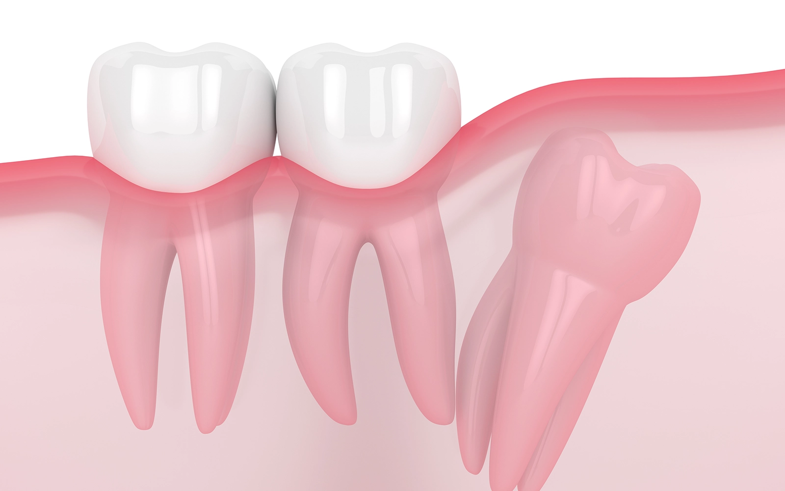 斜めに生えている