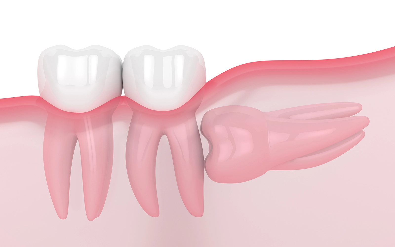 横向きに生えている